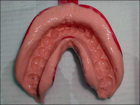 Le bilan première étape du traitement orthodontique.