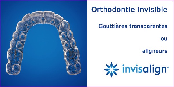 Gouttière transparente ou aligneur:technique Invisalign