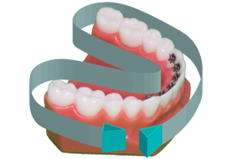 brossage dentaire avec appareil orthodontique-multiattache ou bagues-étape 6