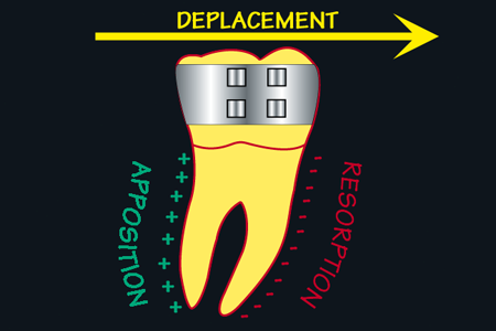 reactions-osseuses-aux-forces-orthodontiques-Deplacement-dentaire