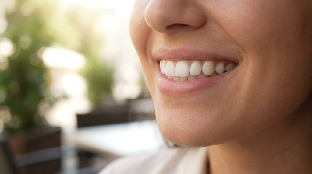 Gros plan sur la bouche souriante d'une personne aux dents blanches et parfaites, évoquant un sourire éclatant.