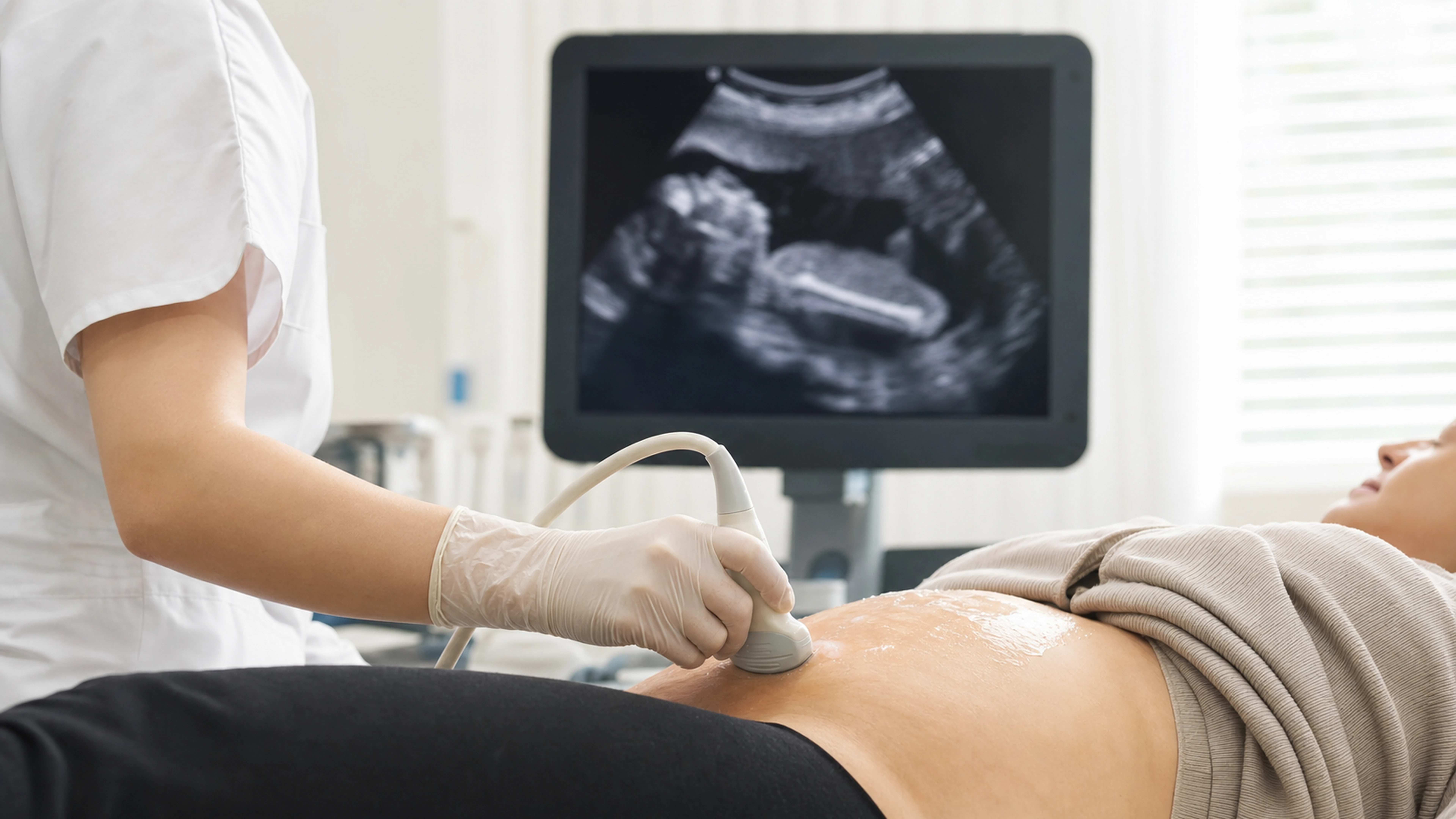 Illustration éditoriale pour l’article « Tout savoir sur la mesure du fémur du foetus en échographie »